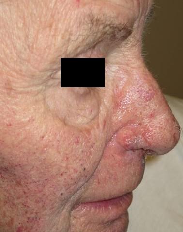 full nostril 7.jpg